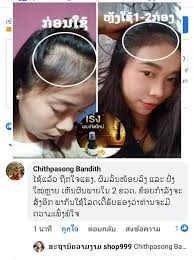 2ກ່ອງຮູ້ເລື່ອງ #ສະເປຜົມປົ່ງ 🔥🔥ຊື້1ແຖມ1🔥🔥