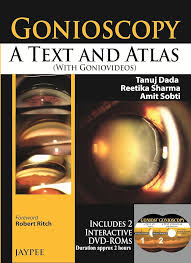 Image result for Gonioscopy