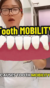 TOOTH MOBILITY pt1 #cause #loose #dentaltips #dentaltok #real #relatable  #fyp #foryourpage #viral #majesteeth