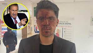 El señor arturo montiel del pri, no sé de política, pero sé que es del pri, él me contrató para tres horas, hice cinco horas de evento en su casa, aquí el señor arturo montiel es un corrupto y un hijo de la chingada, relató en otra transmisión, seguida de una donde vuelve a mostrar los golpes en el. Gsh6wwhgtxlh8m