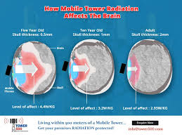 Exposure To Electromagnetic Radiations Emitted By Mobile Towers Could Lead To Serious Brain Injury Special Precautionary Measur Mobile Tower Radiation Tower