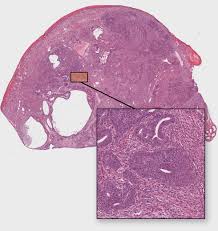 Interestingly, this wasn't the moment that i discovered i had testicular cancer. This Is Why Testicular Cancer Is So Responsive To Chemo Healthcare In Europe Com