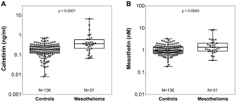 The pancreas is an organ that releases enzymes involved with digestion, and hormones to regular blood sugar levels. Prediagnostic Detection Of Mesothelioma By Circulating Calretinin And Mesothelin A Case Control Comparison Nested Into A Prospective Cohort Of Asbestos Exposed Workers Scientific Reports