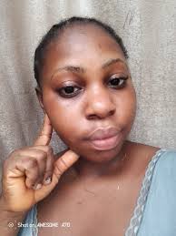 Pls recommend a good cream and face cream for me What can use to clear dark 