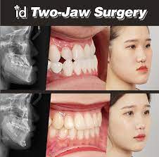 Pin On Jaw Surgery