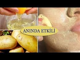 Uygula Gor Aninda Yuz Beyazlatma Mucize Beyazlatici Leke Acici Porselen Cilt Maskesi Guzellik Youtube Evde Agda Dogal Saglik Guzellik