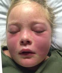 Anthony Lance's Blog