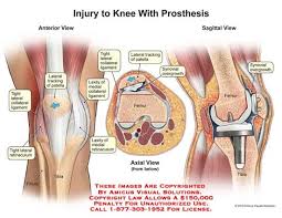 Pin On Medical Images