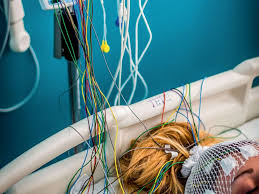 Comment faire une crise d ?pilepsie. Predire Les Crises D Epilepsie Sciences Et Avenir