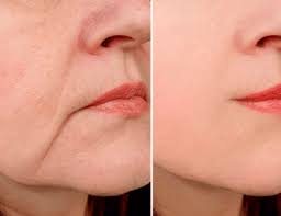 皮肤松弛是衰老？为什么年轻人也会- 伊的家