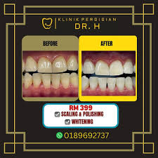 Klinik Pergigian Ha-Teeth - Dental Clinic Muar | Braces | Invisalign | Denture