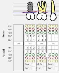 Pearl Dental Software Charting A Periodontal Assessment