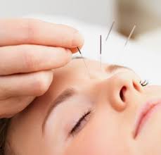 طب سوزنی گوش برای کاهش وزن !!!