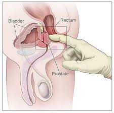 Image result for Prostate Anatomy