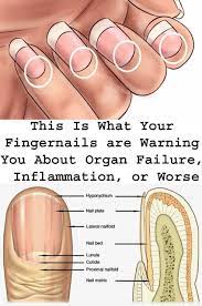 This Is What Your Fingernails Are Warning You About Organ Failure Inflammation Or Worse People Doing Stupid Things Fingernail Health Healthy Facts