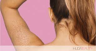 How to get rid of them. What Those Weird Itchy Arm Bumps Are How To Get Rid Of Them Blog Huda Beauty