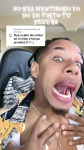 Juan Bernabe Foto Prótesis