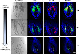 An example for a quantitative trait would be height of a plant, or. Stress Sensing In The Human Greying Hair Follicle Ataxia Telangiectasia Mutated Atm Depletion In Hair Bulb Melanocytes In Canities Prone Scalp Scientific Reports