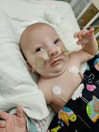 Help for girl with hydrocephalus in Puerto Rico