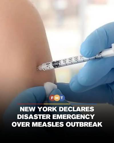 FMTWorld New York State on Monday declared a statewide disaster emergency over a measles outbreak, the first such declaration by a US state since cases began surging in 2025, reported Xinhua. New