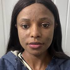 Frodsham, Cheshire Flatmate Frodsham, Cheshire Flatmates Frodsham, Cheshire  Roommates Housemate Lodgers