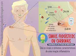 os sinais flogisticos ou cardinais enfermagem ilustrada enfermagem enfermagem farmacologia tecnico em enfermagem