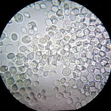 Baker S Yeast Wikipedia