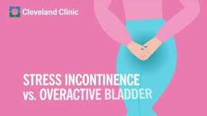 Image result for Stress Incontinence