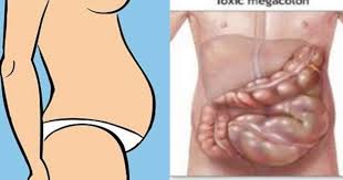 So how are you supposed to get rid of a bloated stomach? You Are Not Fat Your Stomach Is Bloated And Here Is How To Get Rid Of It