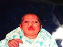 Happy cleft awarness week to all the cleftie warriors xx *tyler was born  with a bclp just like me this is him from newborn to now 1 and a half such  amazing