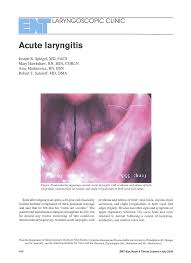 Image result for Acute Laryngitis