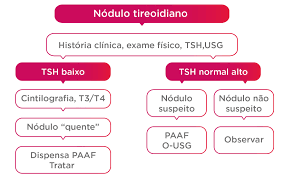 Nódulos e câncer de tireoide: resumo para as provas