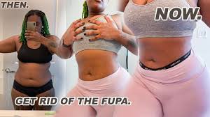 How to get rid of fupa without surgery and surgical procedures is all a matter of the following strategies: How To Get Rid Of Vaginal Fat Fupa Fast Public Health