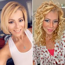 Hair growth after gastric bypass surgery