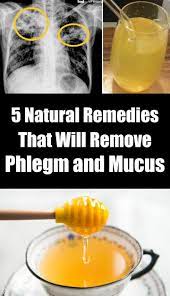 5 Natural Remedies That Will Remove Phlegm And Mucus Natural Remedies Natural Cold Remedies Pnemonia Remedies