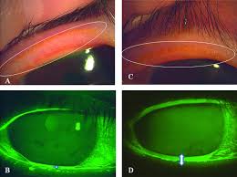 Image result for Dissotis glandulosa