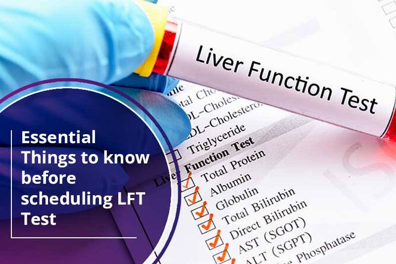LFT - GGT product image