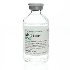 Bupivacaine hydrochloride is not recommended for intravenous regional anesthesia (bier block. Marcaine Injectable 0 5 50ml