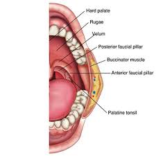 471 the lymph nodes most frequently involved are the cervical ones. Tonsil Surgery Ent Doctor Cape Town Dr Shabeer Ebrahim