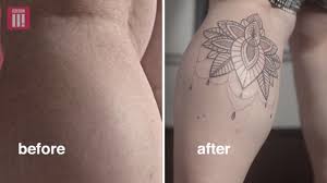 Not only stretch marks tattoo, you could also find another pics such as stretch mark removal, stretch mark beauty, stretch mark girlfriend, stretch mark cream pie, stretch mark treatment, stretch mark scar, and stretch mark quotes. Woman Who Used To Weigh 22 Stone Has Stretch Marks Covered With Tattoo The Independent The Independent