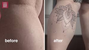 Now you've learned all about tattooing over stretch marks. Woman Who Used To Weigh 22 Stone Has Stretch Marks Covered With Tattoo The Independent The Independent