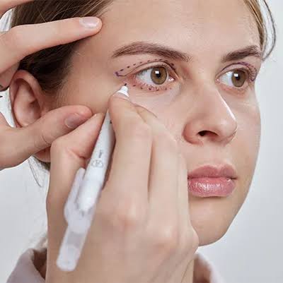 Blepharoplasty Dubai | Eyelid Surgery - HealthBay Aesthetics