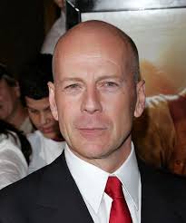 Jason statham's buzz hairstyle is considered one of the main reason for the huge popularity of short buzz hair appearance among the youngsters. 32 Photos Of Bald Celebrities When They Had Hair Bald Actors