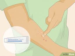 Image result for Fire Ant Sting