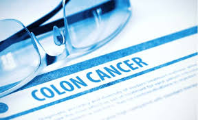 Many are diagnosed at this stage as there are no signs and symptoms at all. Early Signs And Symptoms Of Colon Cancer Medanta