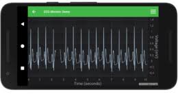 Android Ecg Monitor Fast Native Chart Controls For Wpf