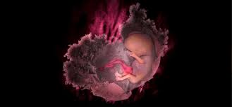 Image result for Recurrent Miscarriage
