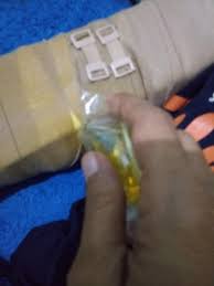 Patah tulang biasanya disebabkan oleh cedera pada tangan. Pengobatan Patah Tulang Secara Alternative Levina Adawiyah
