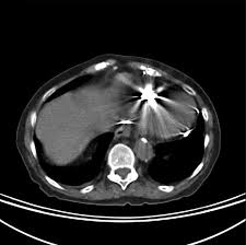 If your scan is for an urgent or emergency situation, or. How Much Does A Ct Scan Cost Near Me From 220