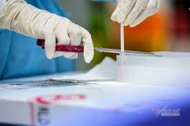 Thời gian biểu hiện triệu chứng cũng có thể dài hơn khiến người bệnh rất khổ sở. Cac Triá»‡u Chá»©ng Phá»• Biáº¿n Cá»§a Chá»§ng Virus Covid 19 Má»›i á»Ÿ Háº£i DÆ°Æ¡ng Vietnamnet